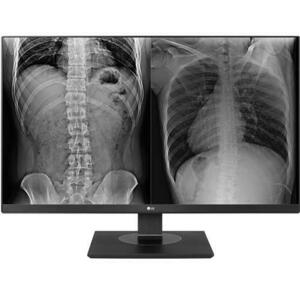 Monitor medical profesional IPS LED LG 27inch 27HJ713C-B, UHD (3840 x 2160), HDMI, DisplayPort, Pivot (Negru) imagine